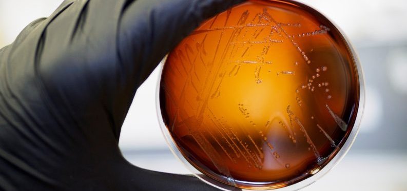 Food,Safety,Pathogen,Listeria,Monocytogenes,Isolated,On,Agar,From,A